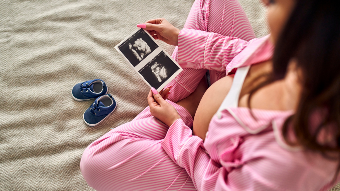 Kobieta w ciąży z usg i bucikami dla dziecka Kobieta w ciąży z usg i bucikami dla dziecka