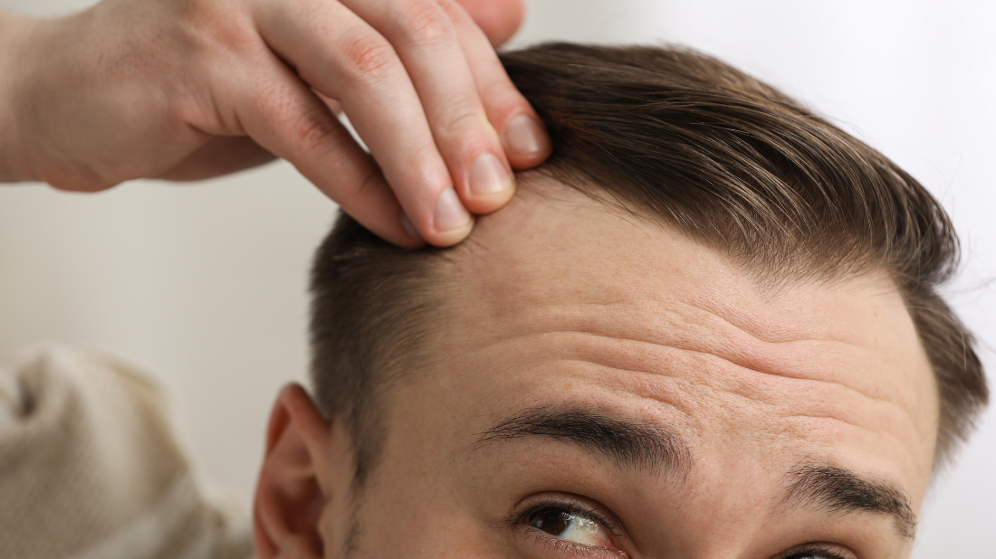 Zakola u mężczyzn Zakola u mężczyzn