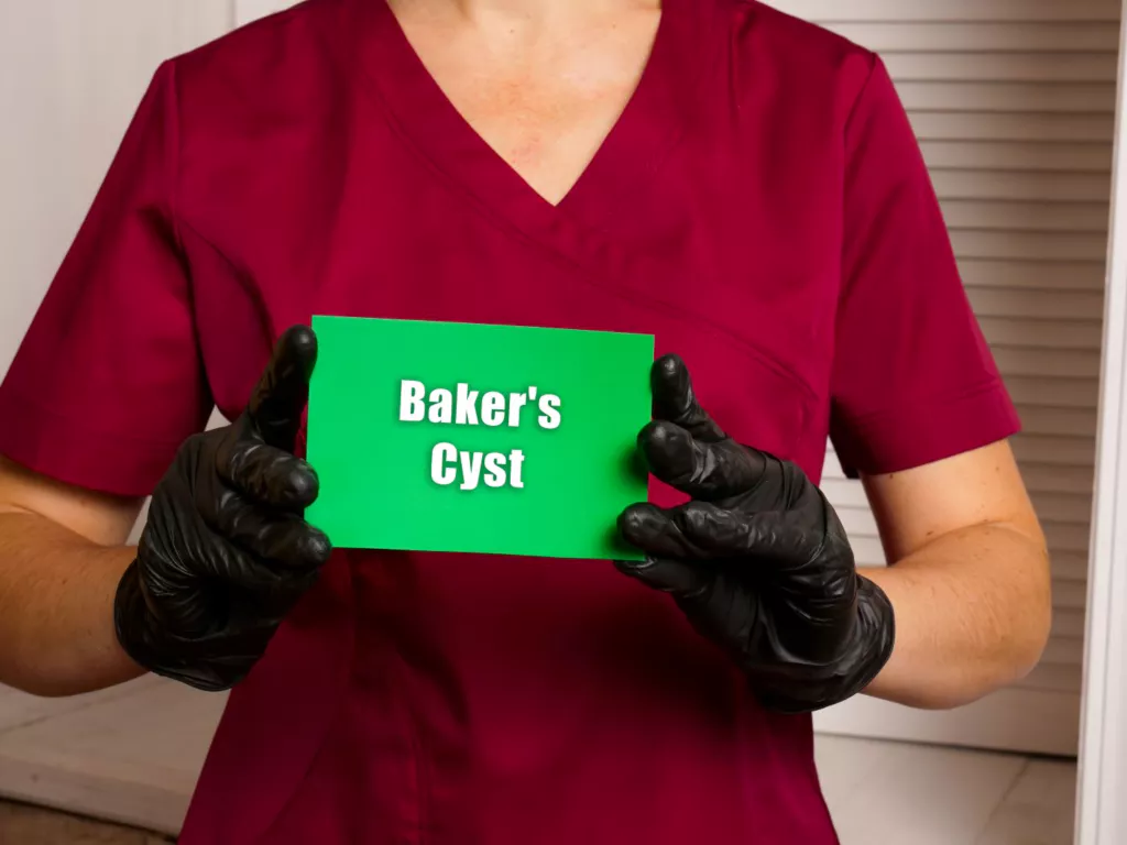 Co to jest torbiel Bakera? Czy jest groźna?