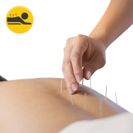 Igły do akupunktury z prowadnicą 100 szt. 0,3 x 75 mm