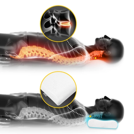 Poduszka ortopedyczna profilowana mała ERGO SMALL