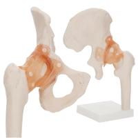 LIFE-SIZE HIP JOINT